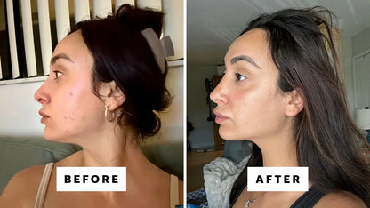 Dark Spot Face Cream with Kojic Acid